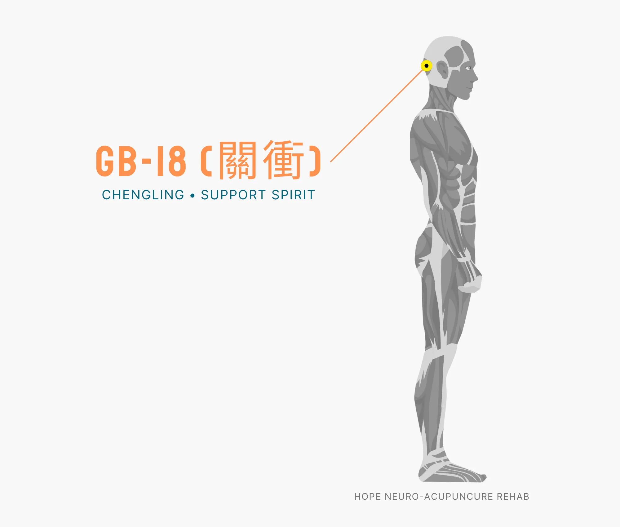 Diagram Showing Where the GB-18 Acupuncture Point (also known as Chengling or Support Spirit) is within the Gallbladder Meridian