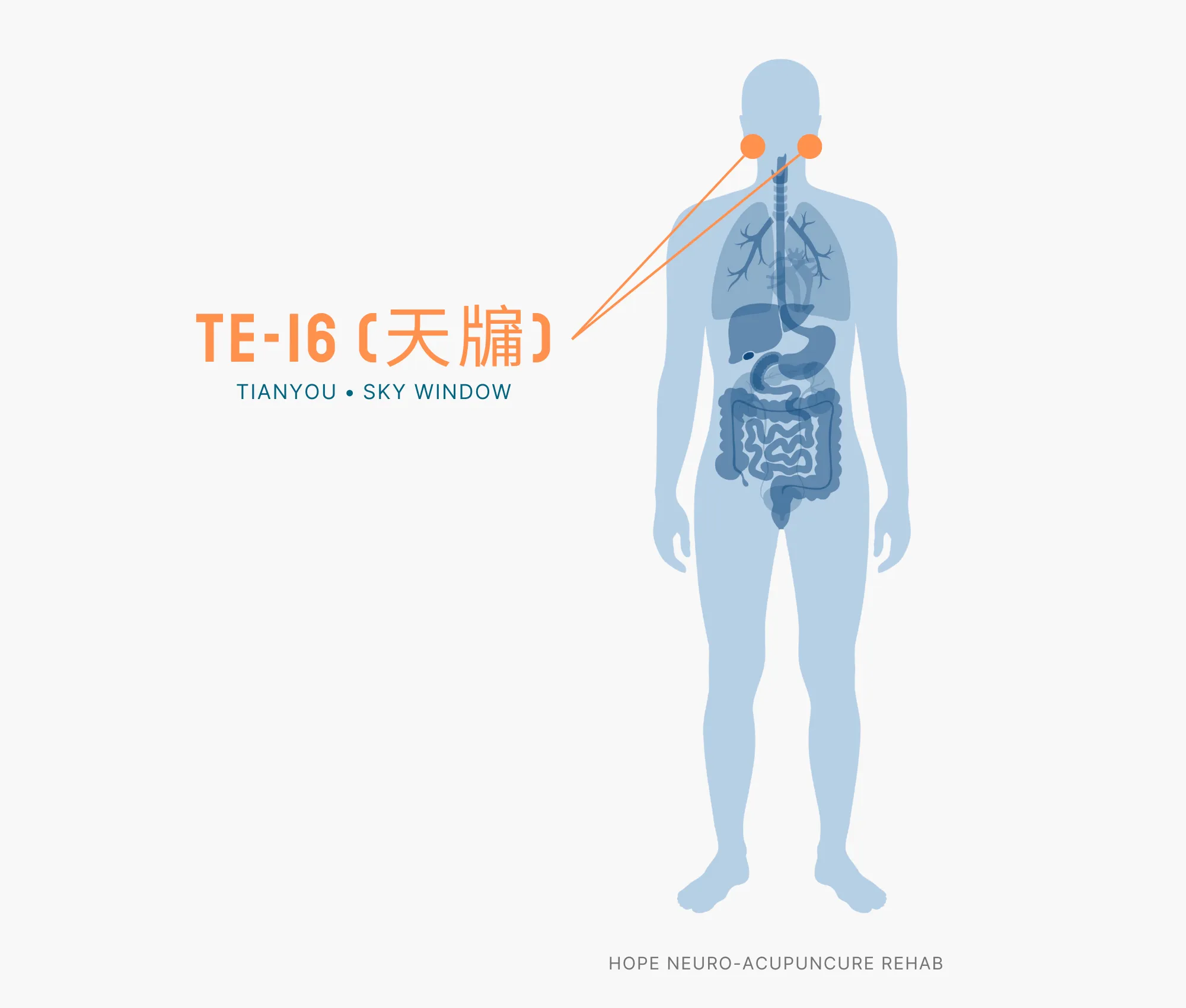 Diagram Showing Where the TE-16 Acupuncture Point (also known as Tianyou or Sky Window) is within the Triple Burner Meridian
