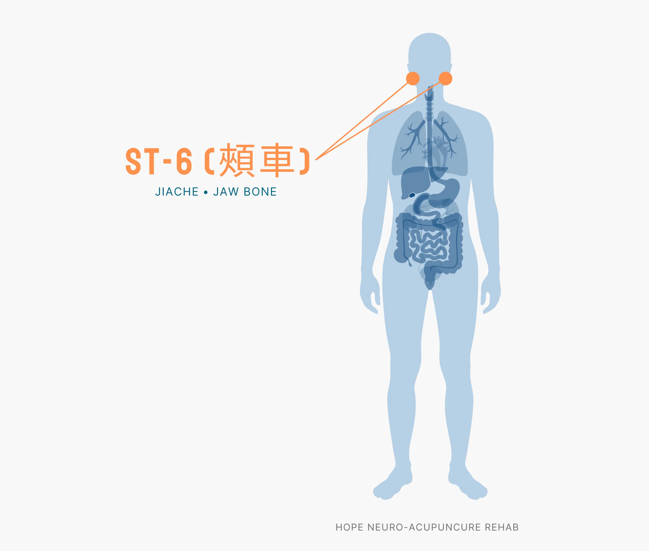 Diagram Showing Where the ST-6 Acupuncture Point (also known as Jiache or Jaw Bone) is within the Stomach Meridians