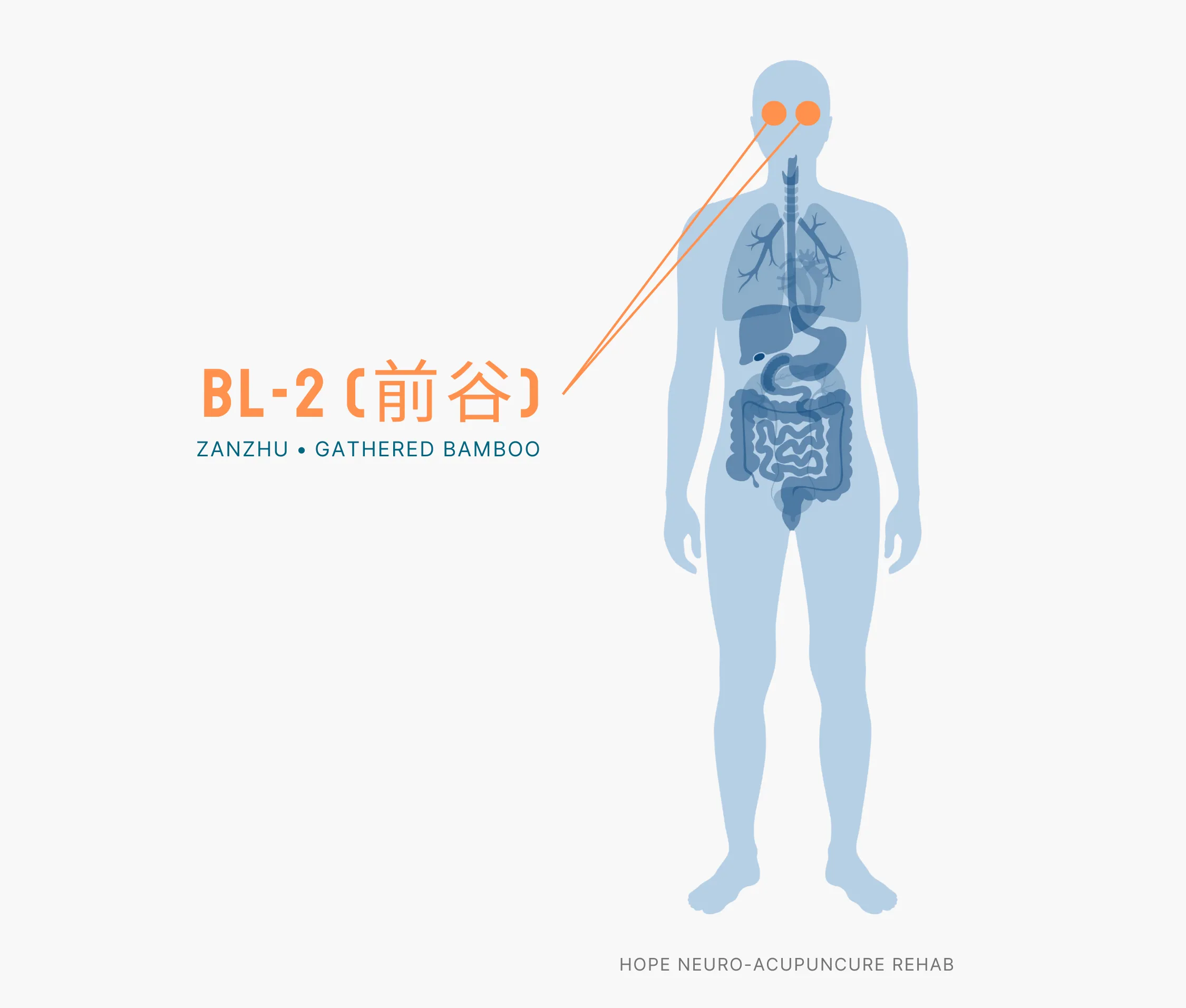 Diagram Showing Where the BL-2 Acupuncture Point (also known as Zanzhu or Gathered Bamboo) is within the Bladder Meridians