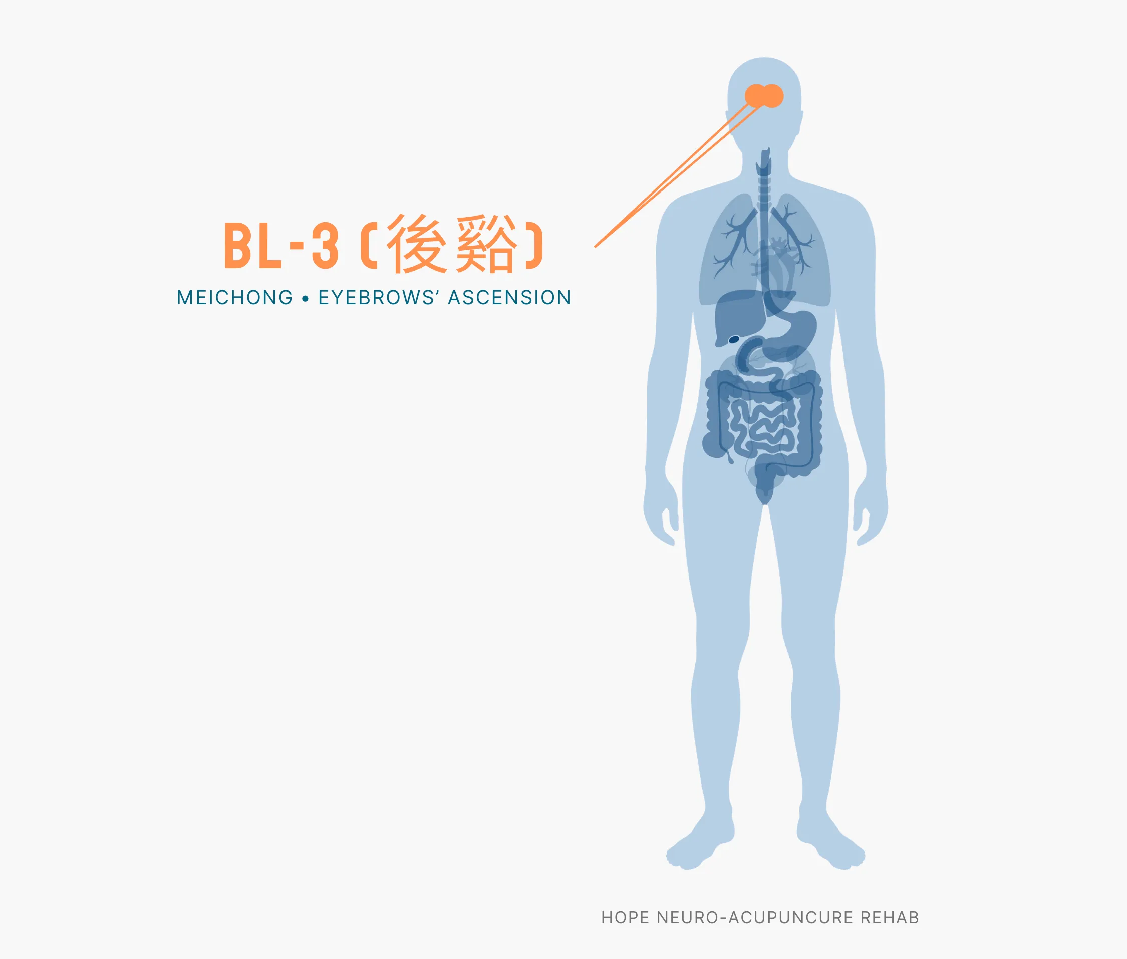 Diagram Showing Where the BL-3 Acupuncture Point (also known as Meichong or Eyebrows' Ascension) is within the Bladder Meridians