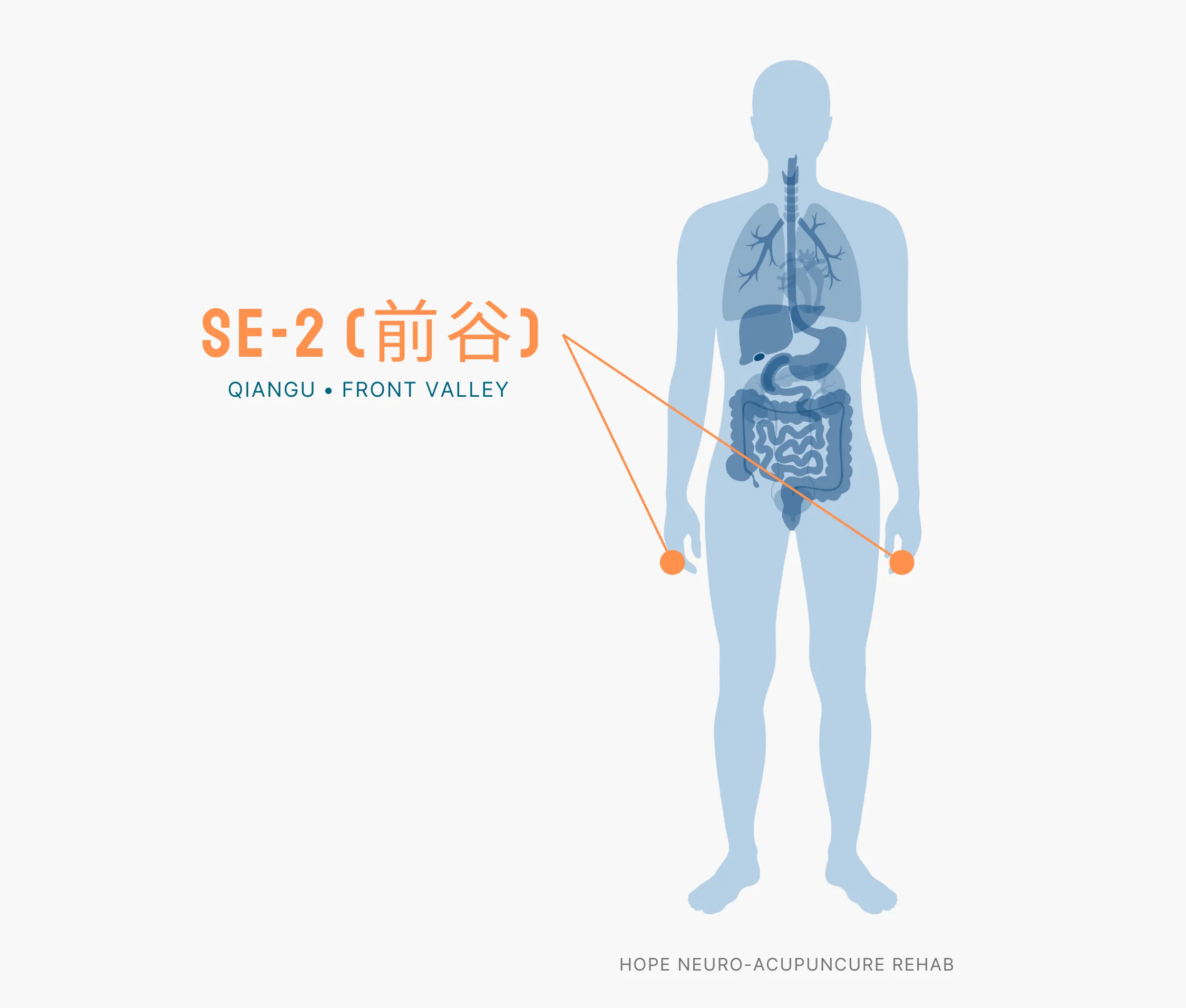 Diagram Showing Where the SI-2 Acupuncture Point (also known as Qiangu or Front Valley) is within the Small Intestine Meridians