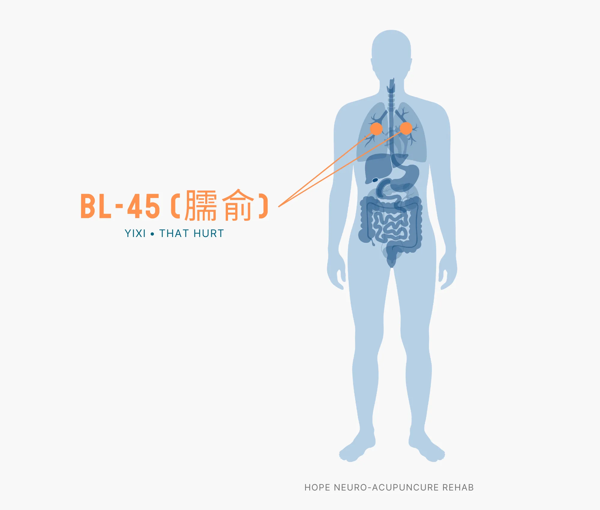Diagram Showing Where the BL-45 Acupuncture Point (also known as Yixi or That Hurt) is within the Bladder Meridians