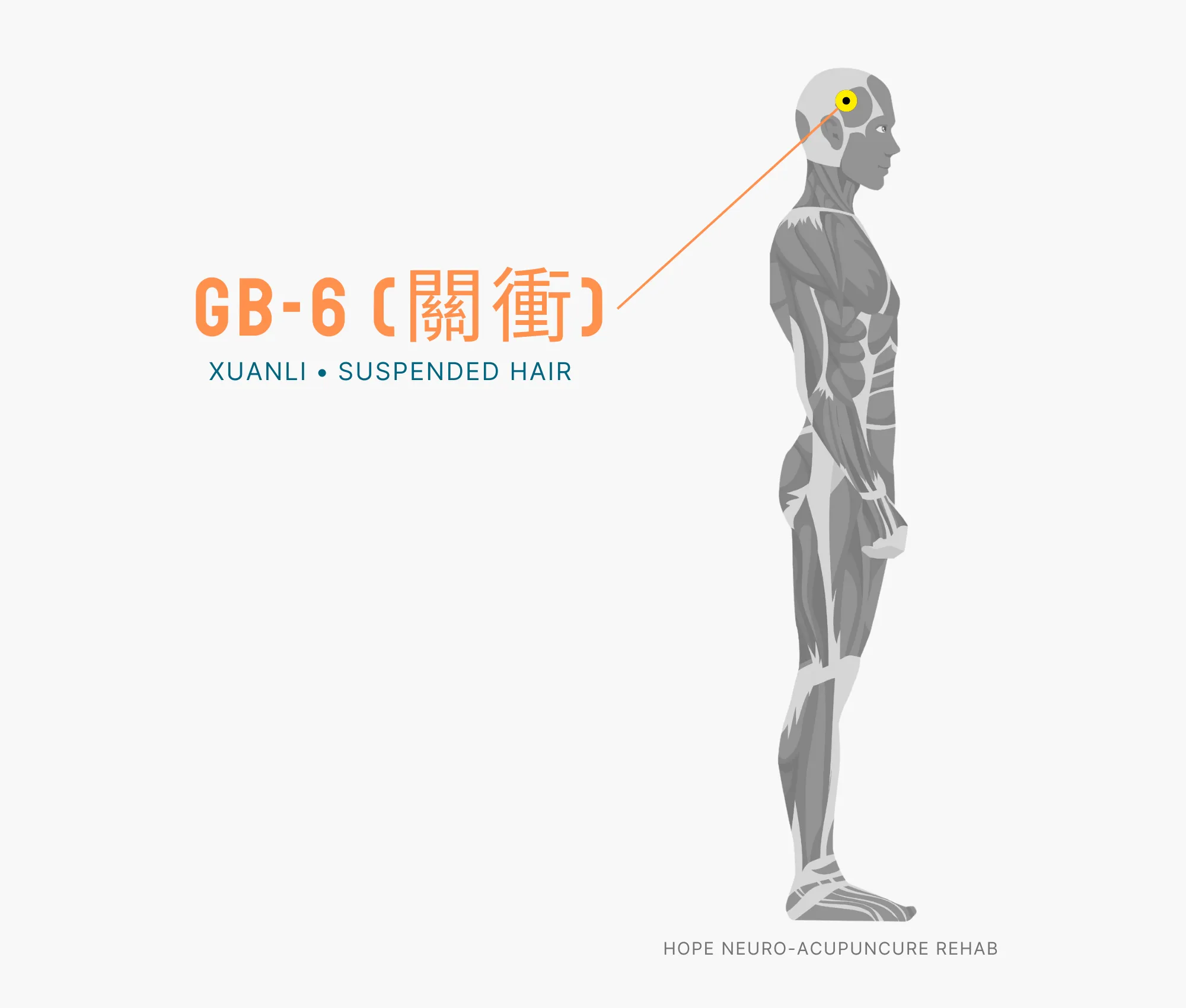Diagram Showing Where the GB-1 Acupuncture Point (also known as (Tongziliao or Pupil Crevice) is within the Gallbladder Meridian