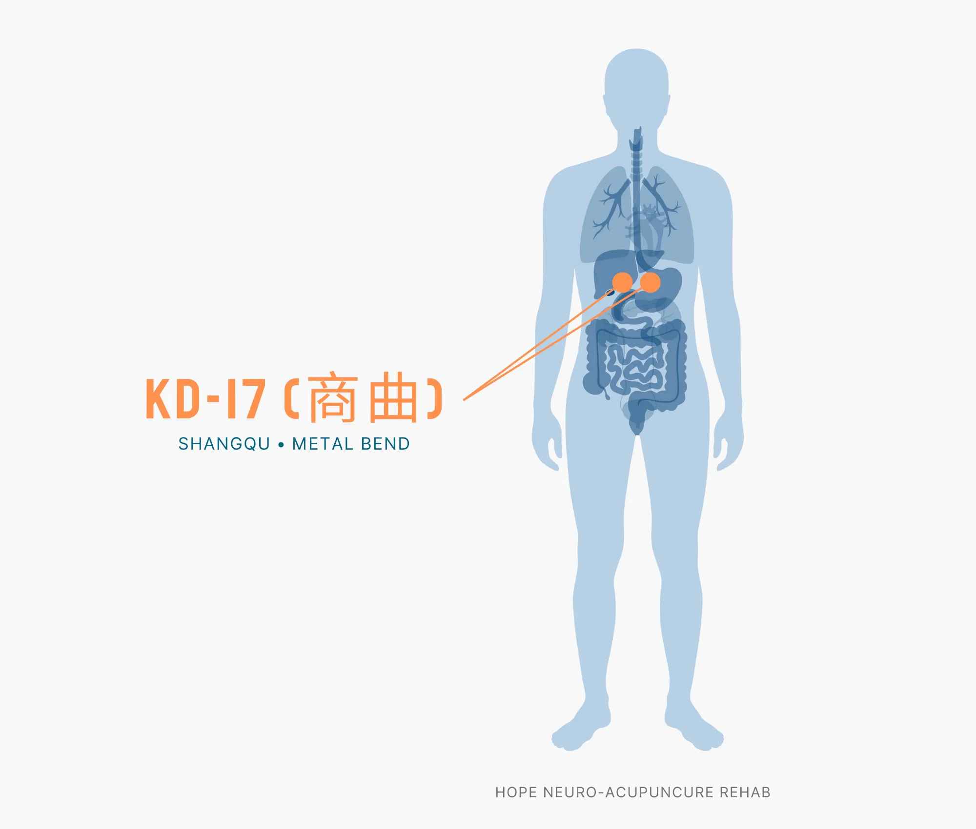 Diagram Showing Where the KD-17 Acupuncture Point (also known as Shangqu or Metal Bend) is within the Kidney Meridians