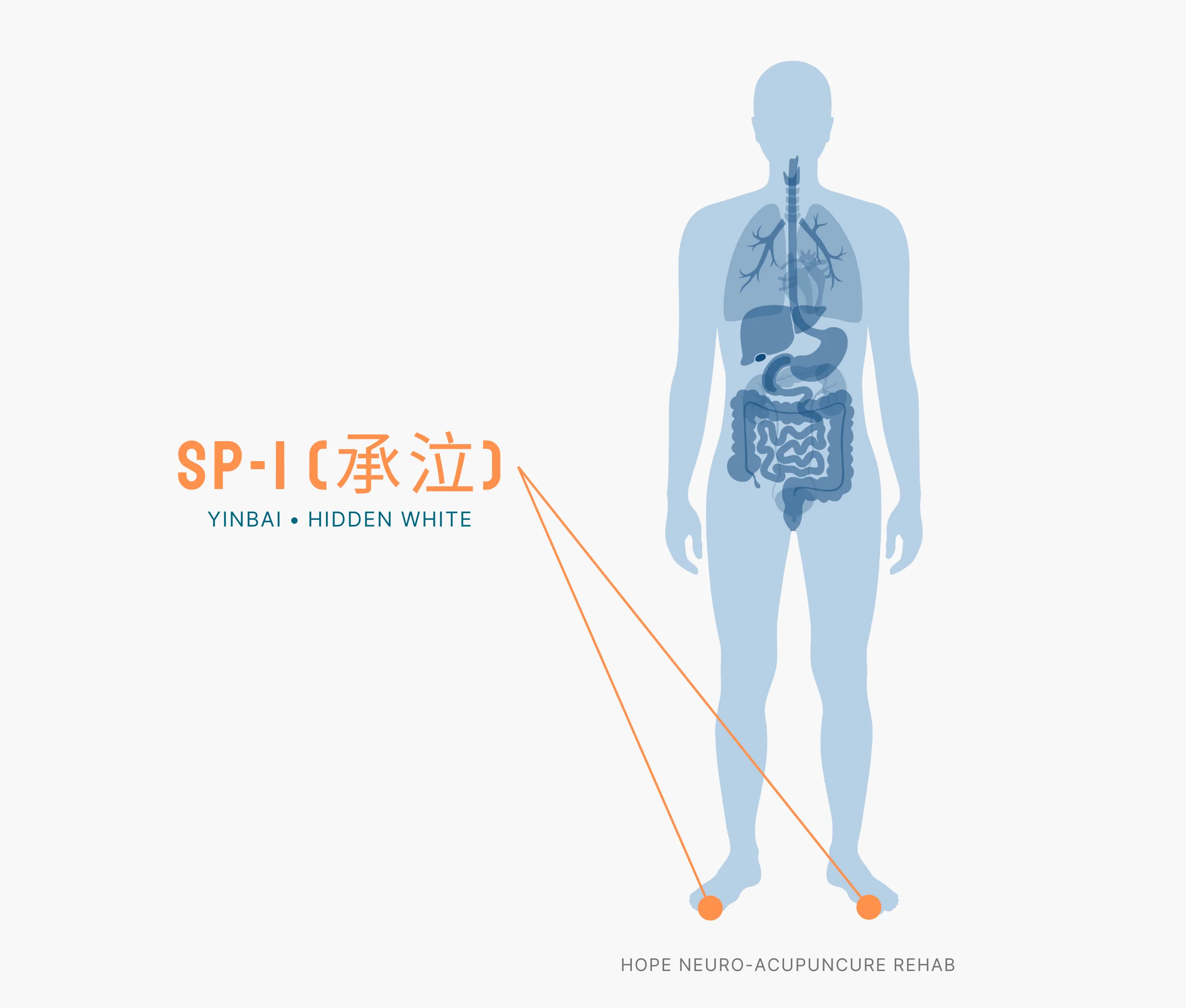 Diagram Showing Where the SP-1 Acupuncture Point (also known as Yinbai or Hidden White) is within the Spleen Meridians