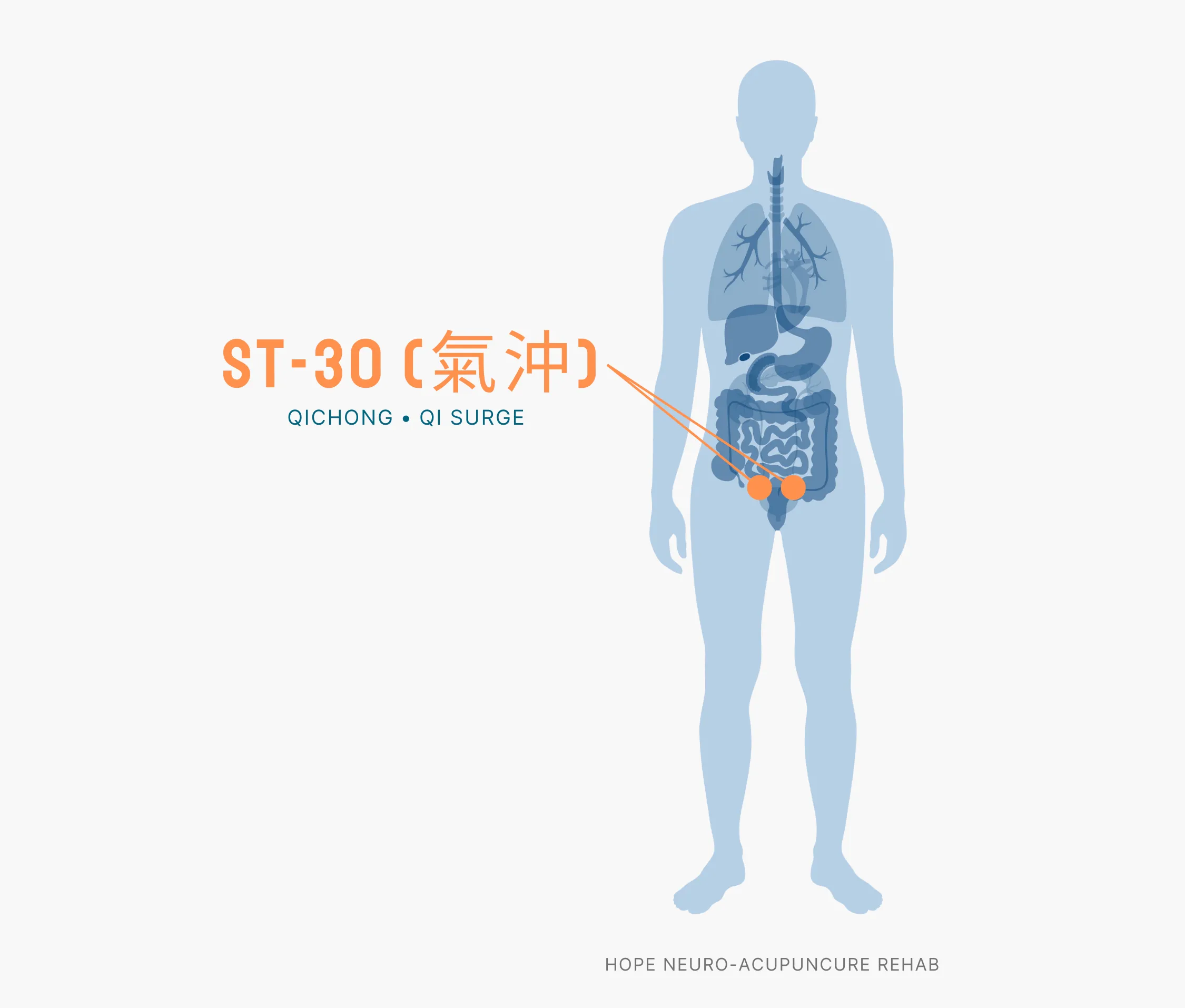 Diagram Showing Where the ST-30 Acupuncture Point (also known as Qichong or Qi Surge) is within the Stomach Meridians