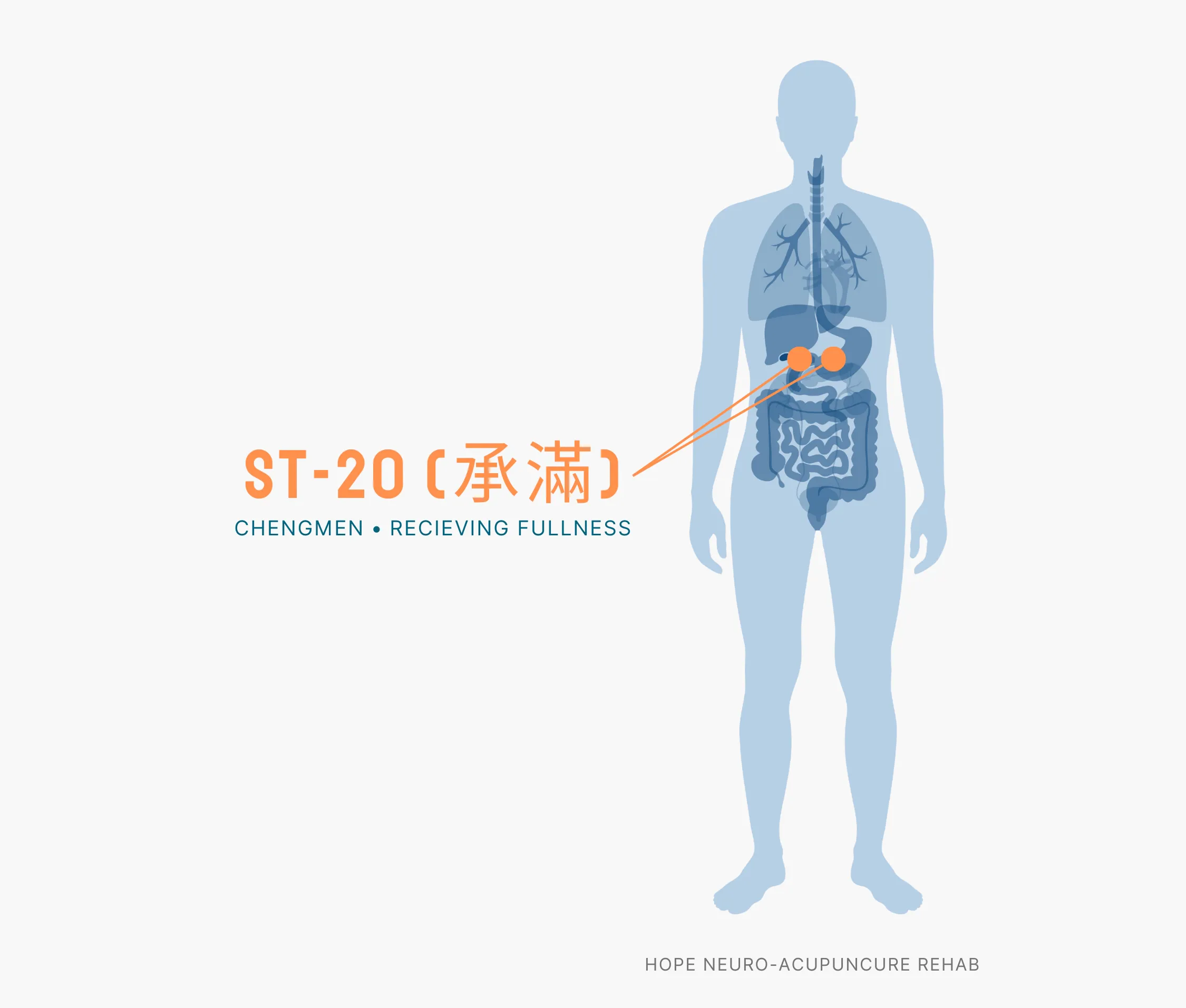 Diagram Showing Where the ST-20 Acupuncture Point (also known as Chengmen or Recieving Fullness) is within the Stomach Meridians