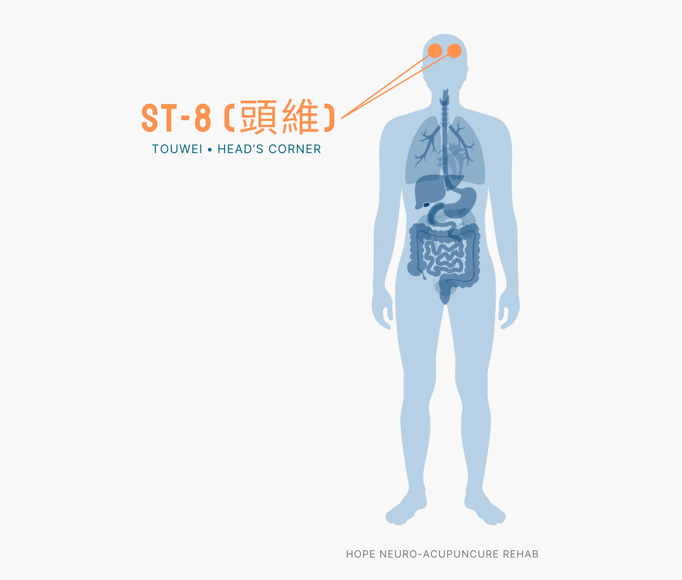 Diagram Showing Where the ST-8 Acupuncture Point (also known as Touwei or Head's Corner) is within the Stomach Meridians