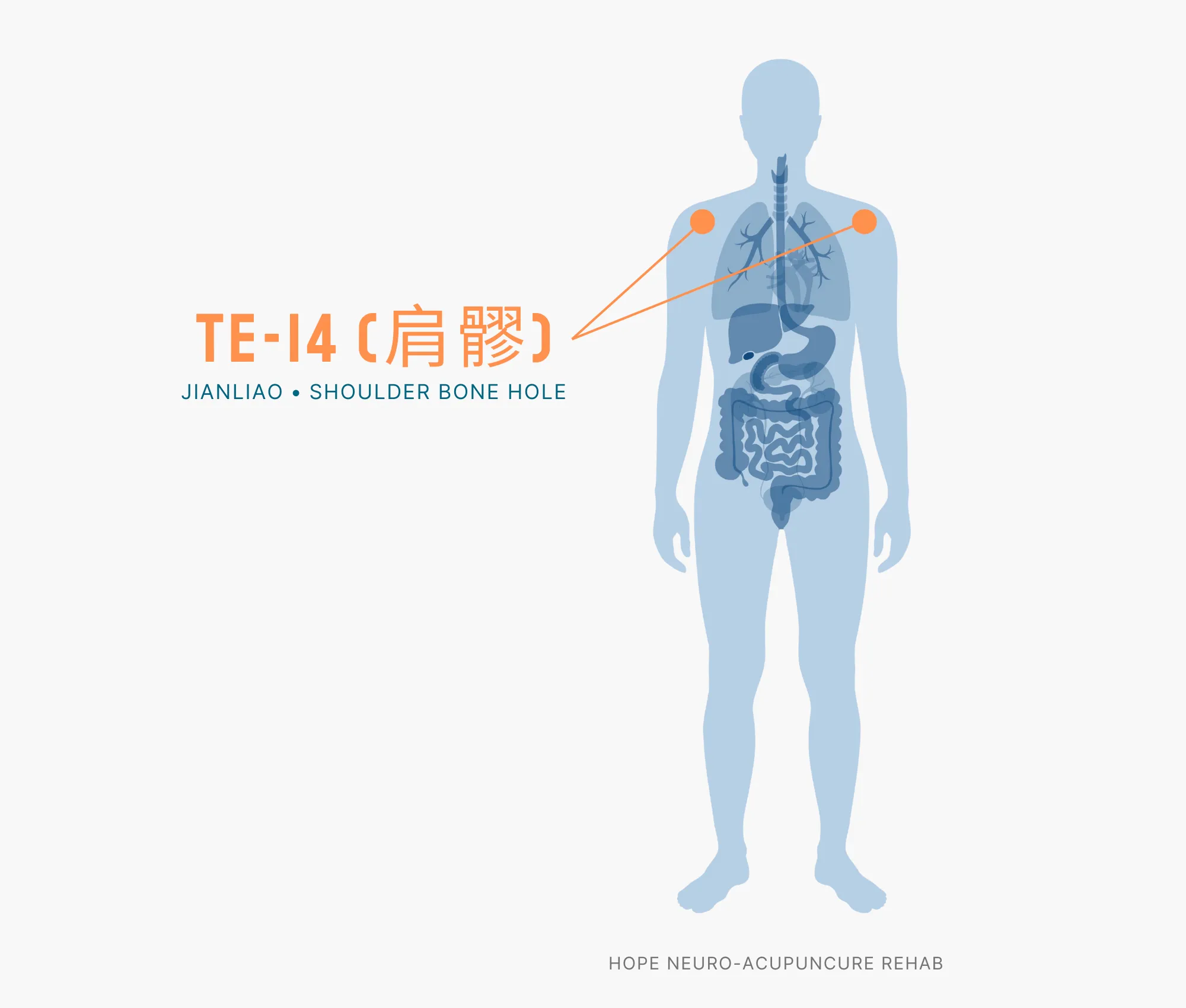 Diagram Showing Where the TE-14 Acupuncture Point (also known as Jianliao or Shoulder Bone Hole) is within the Triple Burner Meridian