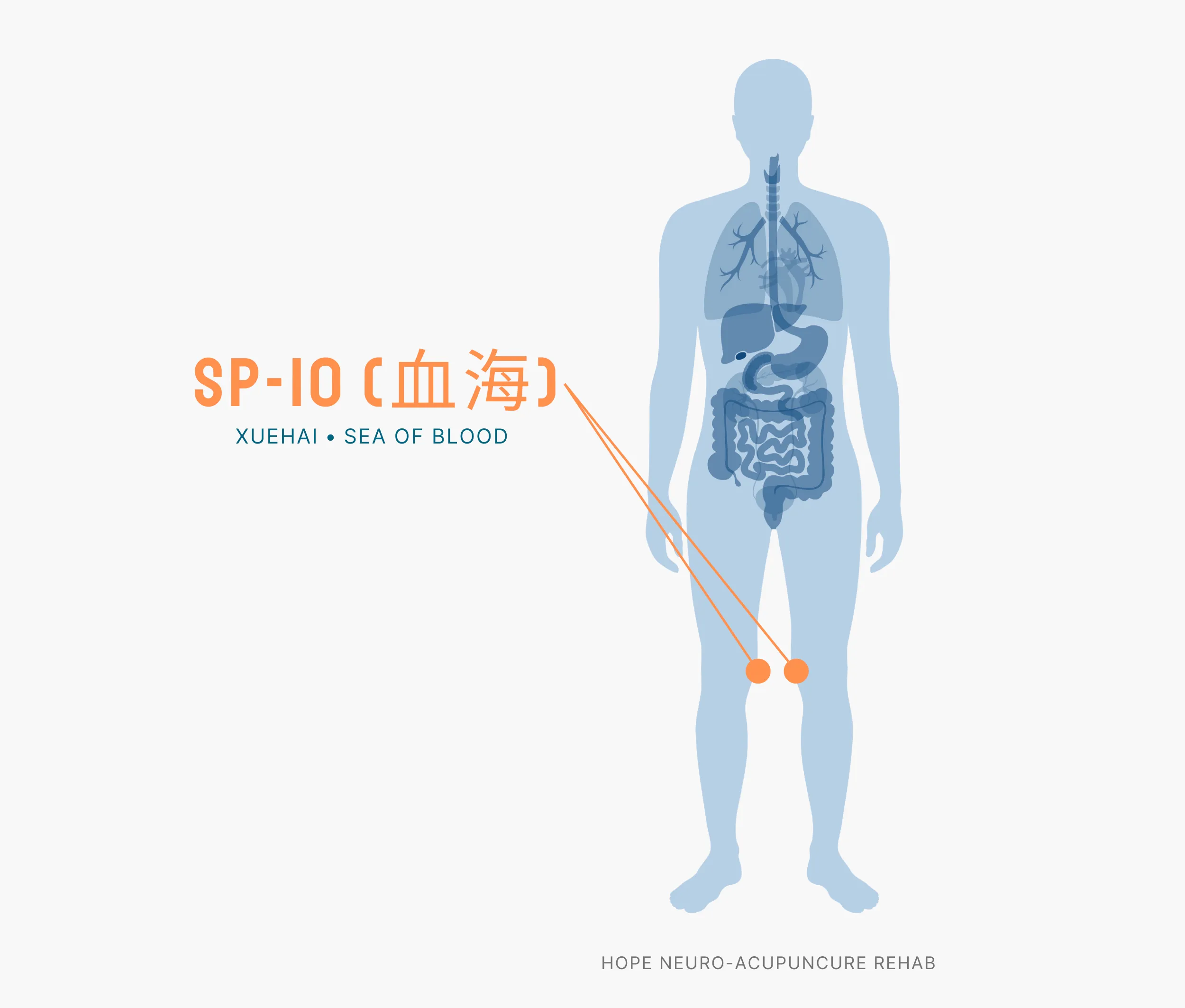 Diagram Showing Where the SP-10 Acupuncture Point (also known as Xuehai or Sea of Blood) is within the Spleen Meridians