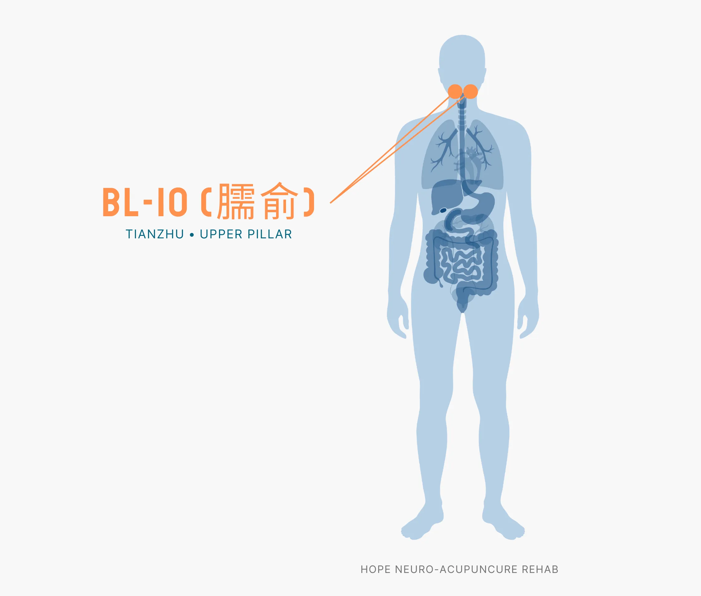 Diagram Showing Where the BL-10 Acupuncture Point (also known as Tianzhu or Upper Pillar) is within the Bladder Meridians