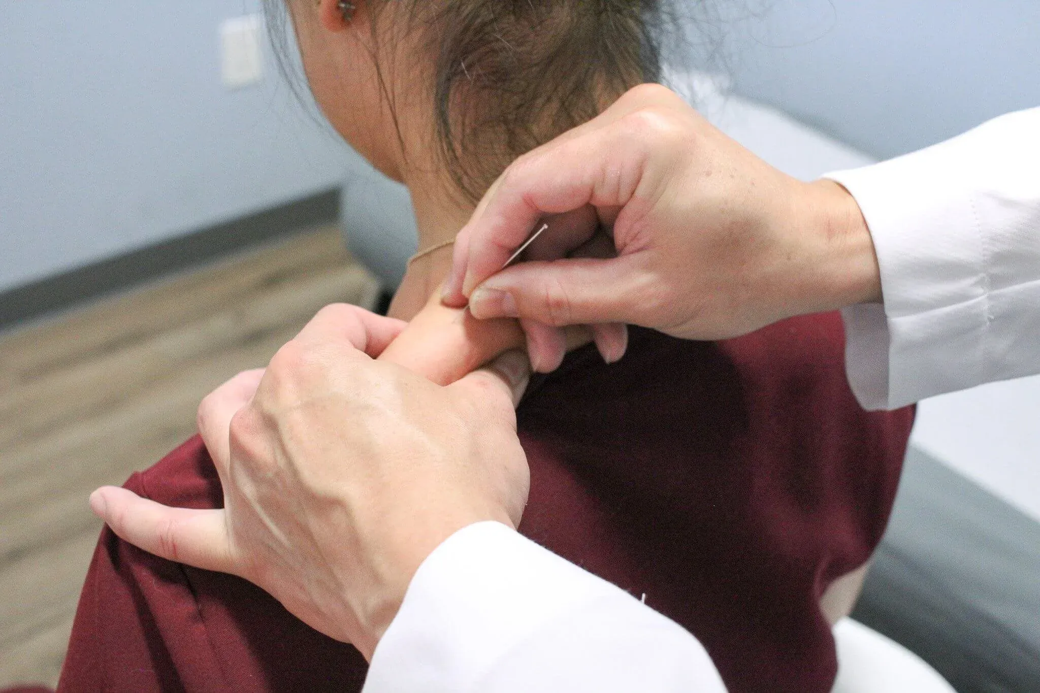 Close-up of dry needling treatment